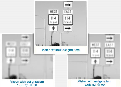Illustration Showing Vision With Astigmatism